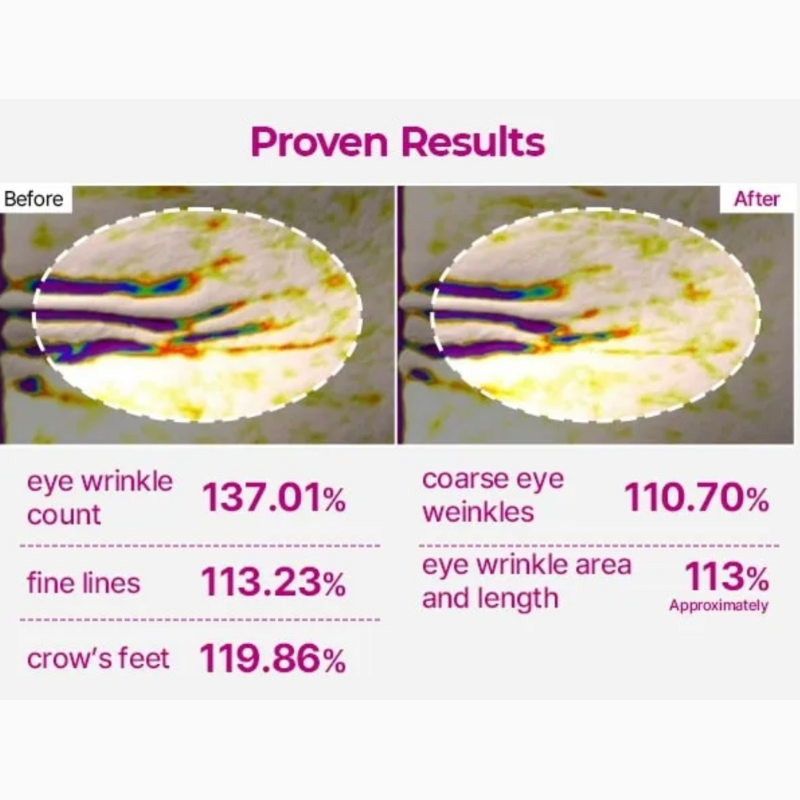 Cemenrete Calcium Volume Eye Patch