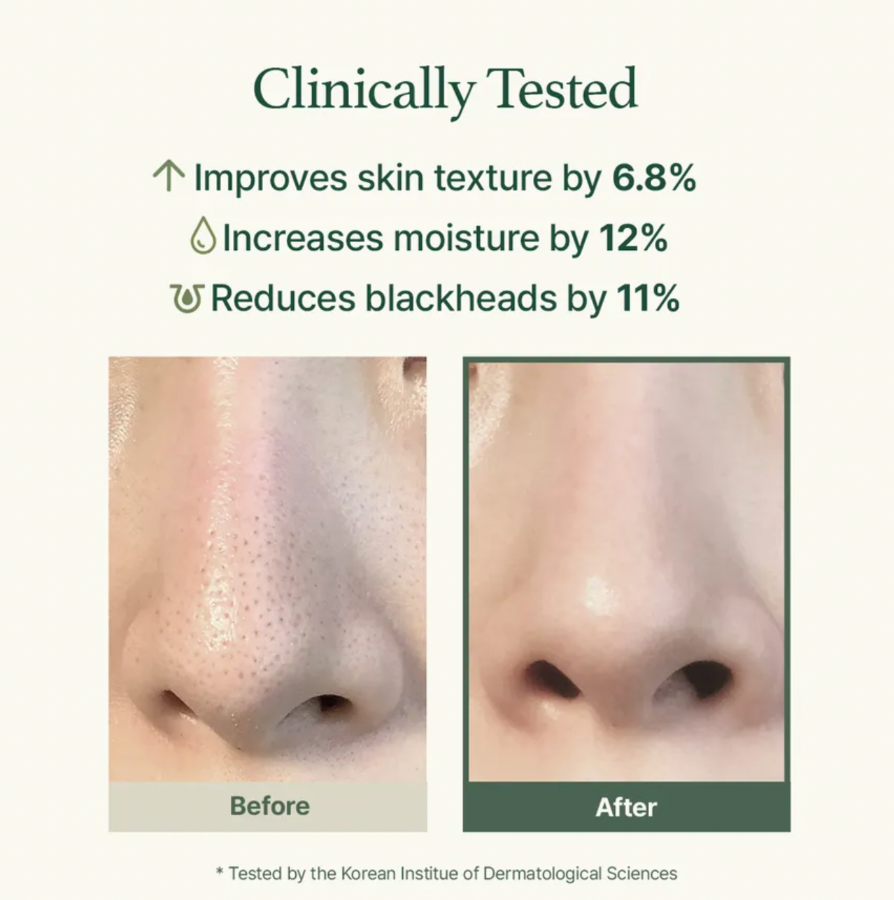 Before and after comparison of skin texture improvement with clinical benefits listed.
