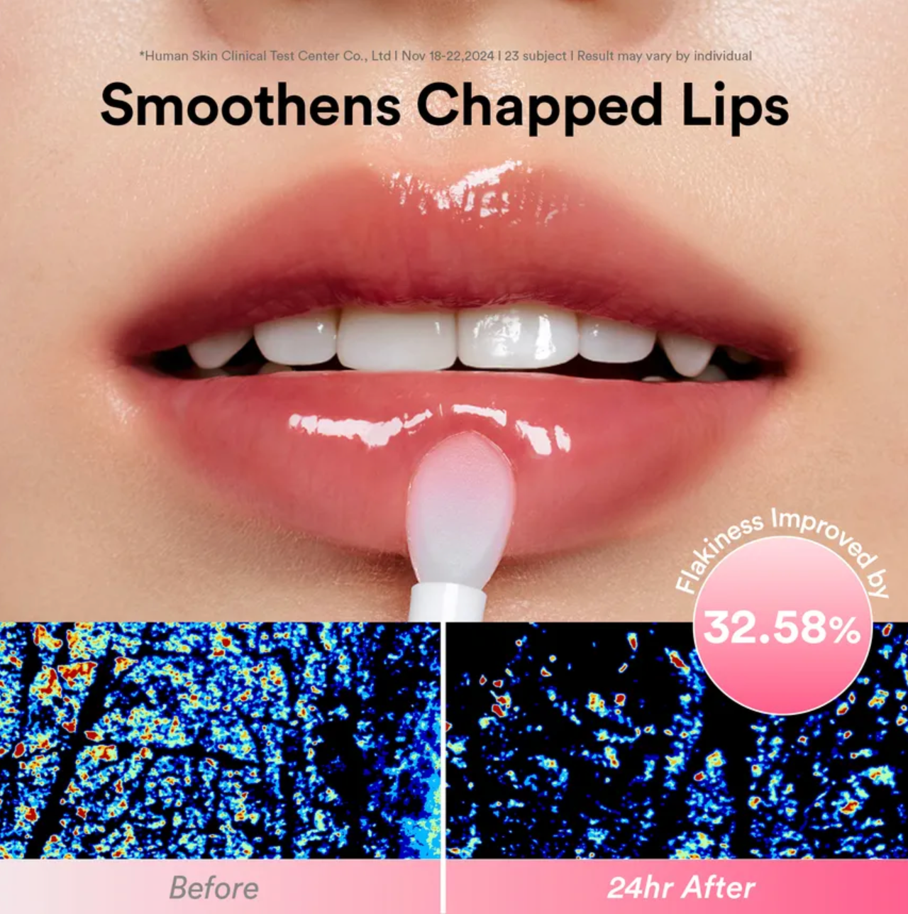 Lip balm with a before and after effect on lips, showing smoothness improvement.
