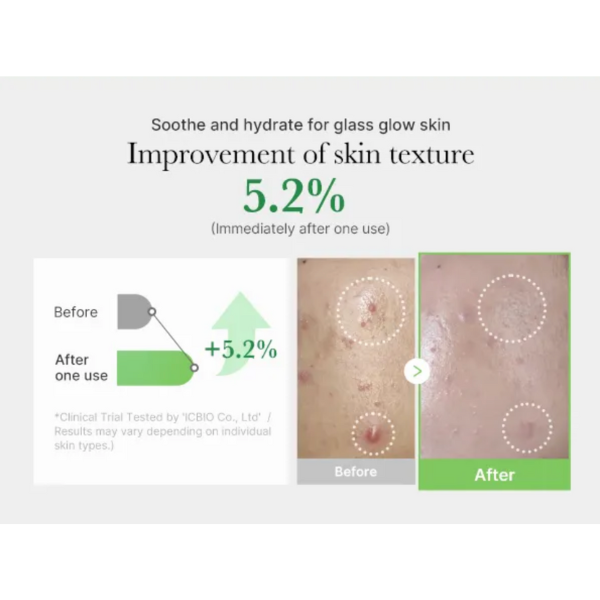 Before and after skin texture improvement with a 5.2% increase, shown on a white background.