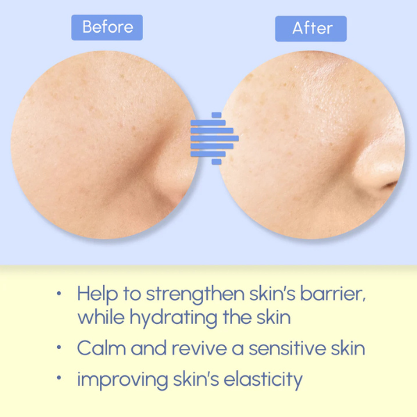 Before and after comparison of skin with text highlighting benefits on a blue background