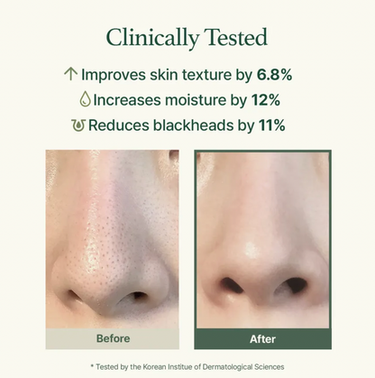 Before and after comparison of skin texture improvement with clinical benefits listed.
