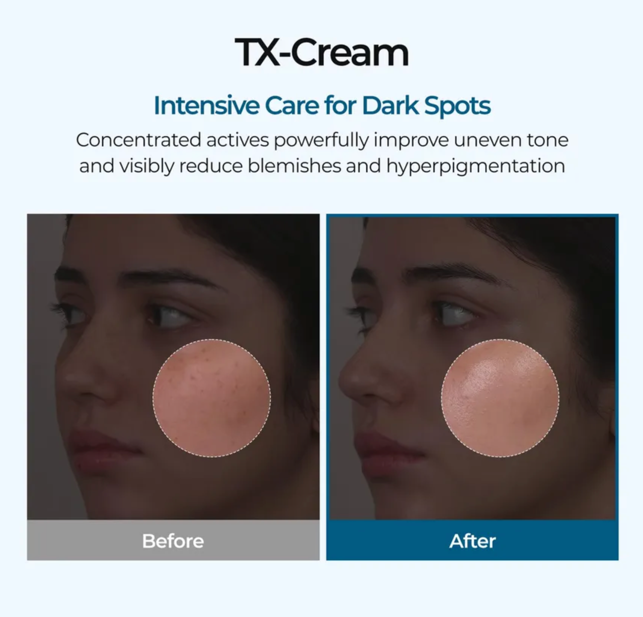 TX Cream