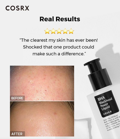 Cosrx BHA Blackhead Power Liquid with before and after skin comparison and customer review.