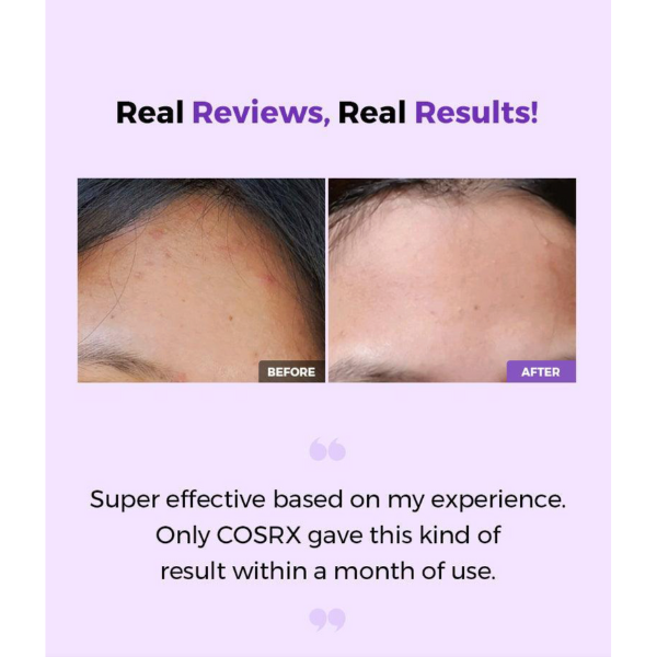 Before and after comparison of skin treatment with text about real reviews and results.